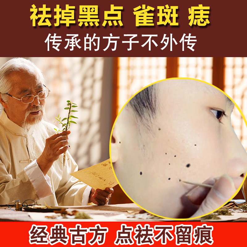 点痣水无痕药水正品脸部祛痣水膏点痦子取去痣黑痣不留疤点斑雀斑