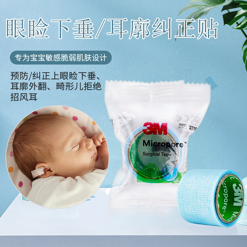 3M医用硅胶耳廓矫正贴宝宝婴儿敏感肌肤专用胶布纠正耳朵闭嘴呼吸