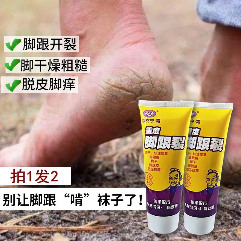 脚跟裂防脚裂膏脚后跟开裂脚干脚裂口子神器龟裂皲裂膏护脚霜直销|ruв категории туалетные чище/санитарно - гигиенических салфеток/бумага/Ароматерапия, шампунь/человек чистой, уход за телом, крем для рук - от Buy2taobao.com для оказания профессиональной услуги покупки агента Taobao