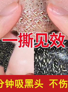 冰菊鼻贴吸黑头粉刺男女士专用