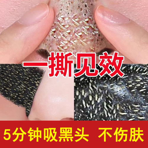 冰菊鼻贴吸黑头粉刺男女士专用