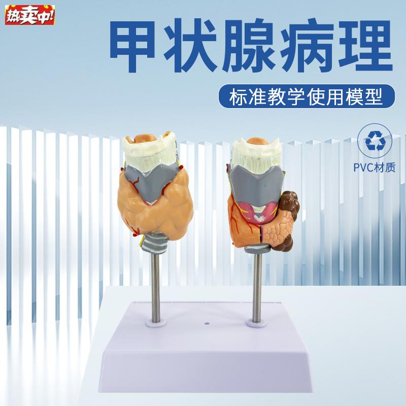 病理甲状腺模型喉头解剖模型甲状腺留L甲状线囊中甲状线病