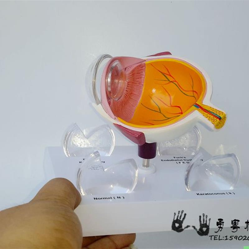 眼球疾病 眼睛解剖 眼球构造 角膜疾病 眼球模型 眼睛模型
