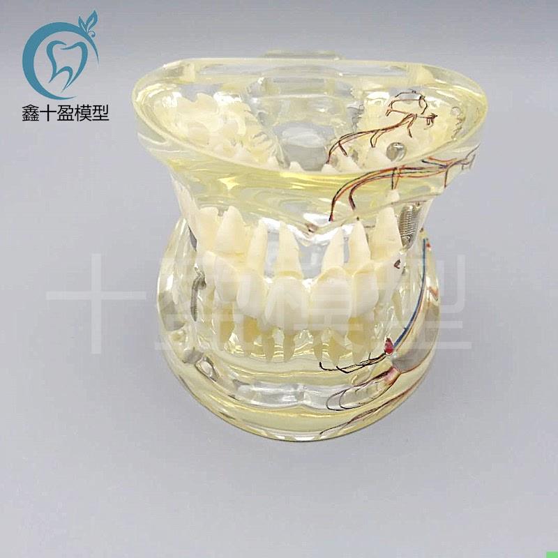 牙科水晶牙齿病理模型M4019-2成人透明病理牙模型 带牙神经和嵌体