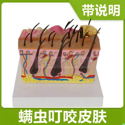 皮肤模型病理蚊虫叮咬过程皮下病变医美微整形皮肤美容带说明礼品