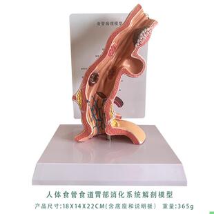 人体食管食道胃部消化系统解剖模型教学内脏解剖人体教具厂家直销