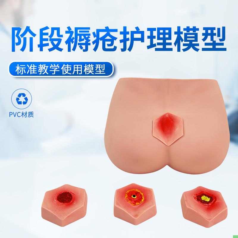 阶段褥疮护理模型养老护理教学模型四个不同阶段褥疮护理训练模型