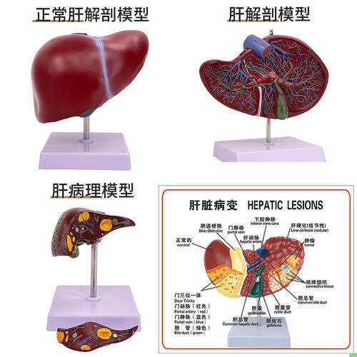 15009肝胆囊放大模型 人体肝胆囊肝脏人体消化器官内脏解剖模型