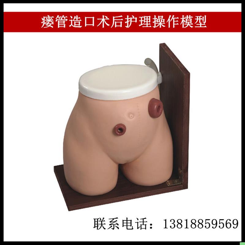 瘘管造口术后护理操作模型