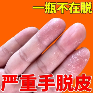 老板娘力推好物【一抹止痒】用过的都说好 买2送一 活动中