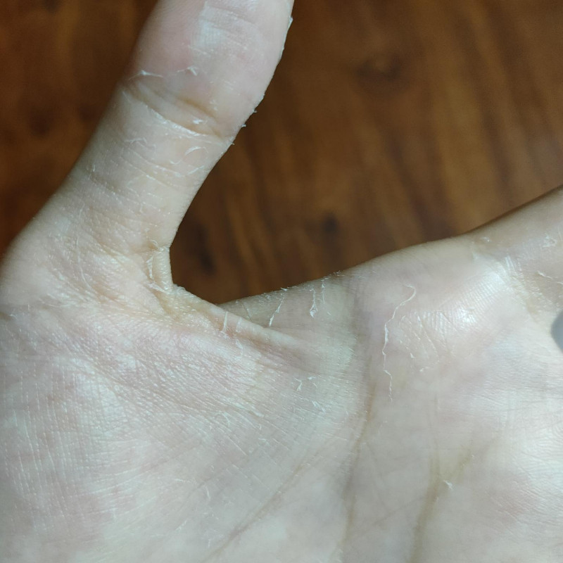 26手脱皮脚脱皮专用手掌蜕皮起皮膏护手霜干裂手指头脱皮脚底干燥