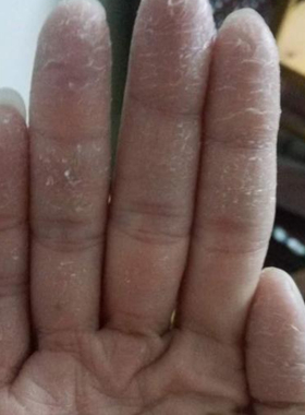 万人推荐10407【消不了分文不取】活动中 买2送1，买4送2