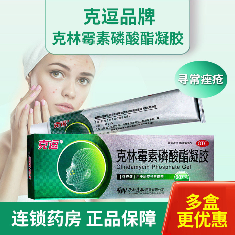克逗 克林霉素磷酸酯凝胶20g 用于治疗寻常痤疮