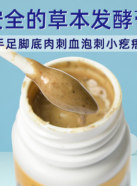 手足多肉丁去除神器药肉刺专用膏去肉疙瘩血泡刺灵鸡特效乳膏