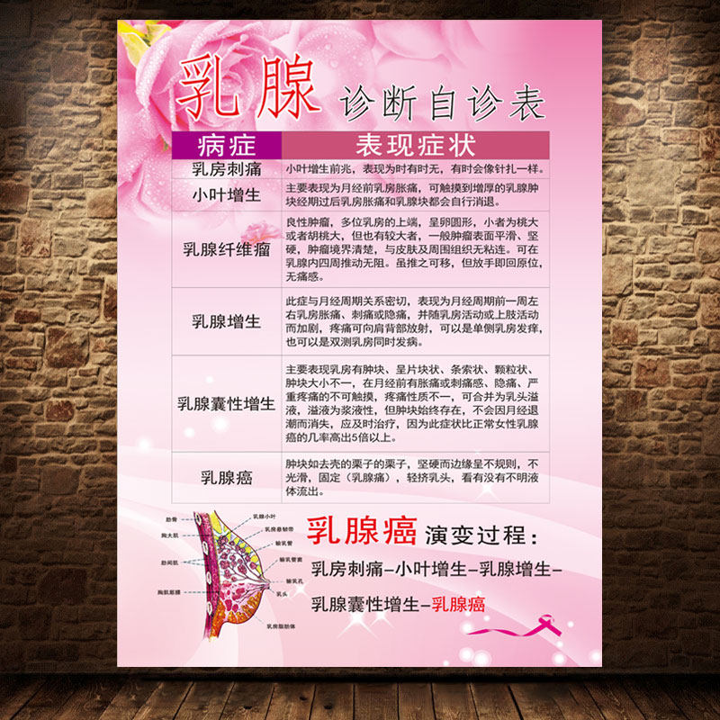 乳腺诊断自诊表乳腺癌海报乳房保养挂图美容院养生馆疏通宣传画