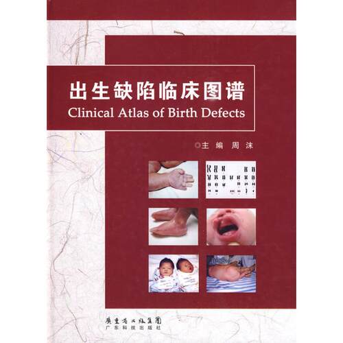 （正版包邮）出生缺陷临床图谱9787535951229广东科技出版社