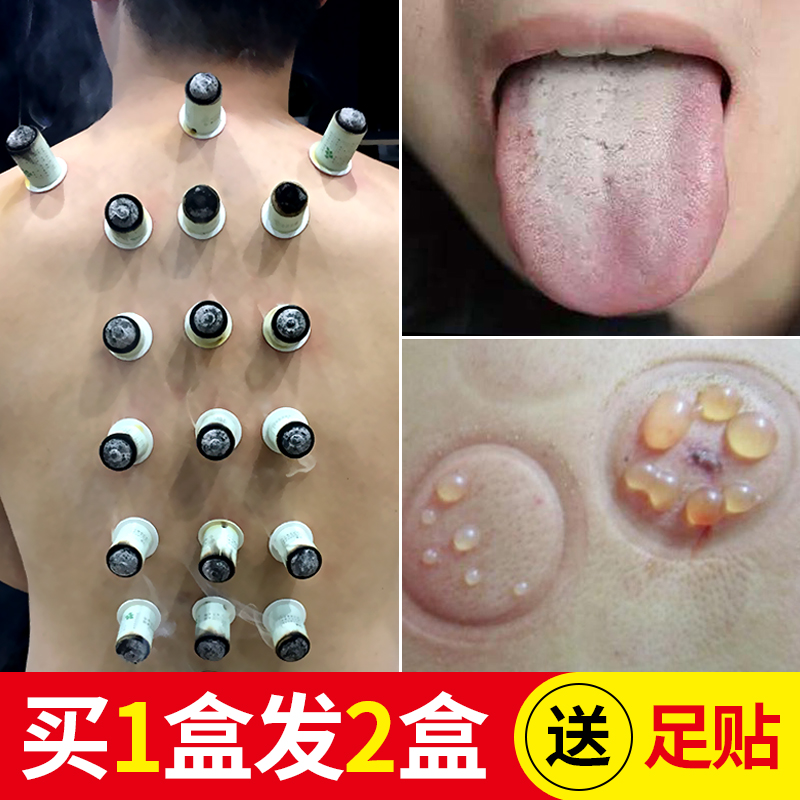 艾灸貼艾柱貼艾灸柱加粗五年陳艾條艾柱艾絨隨身小筒灸艾艾 灸 貼