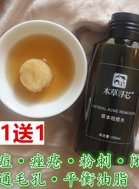 【散装无盒】草本qu痘水 xiao炎去cuo疮粉刺闭口 疏通毛孔青春痘
