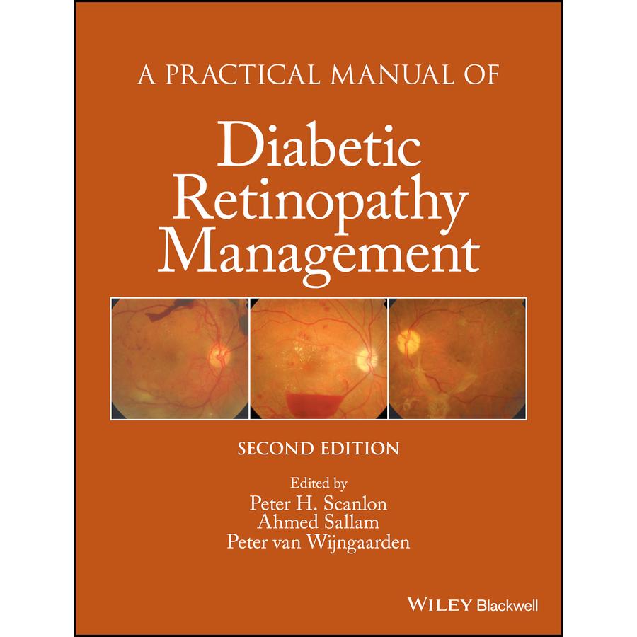 【预售 按需印刷】英文原版实用手册糖尿病视网膜病变2版Practical Manual Diabetic Retino 2e原装进口正版书籍