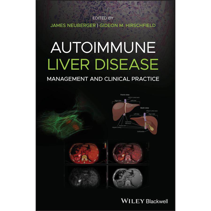 【预售 按需印刷】英文原版自身免疫性肝病 PAutoimmune Liver Disease P原装进口正版书籍