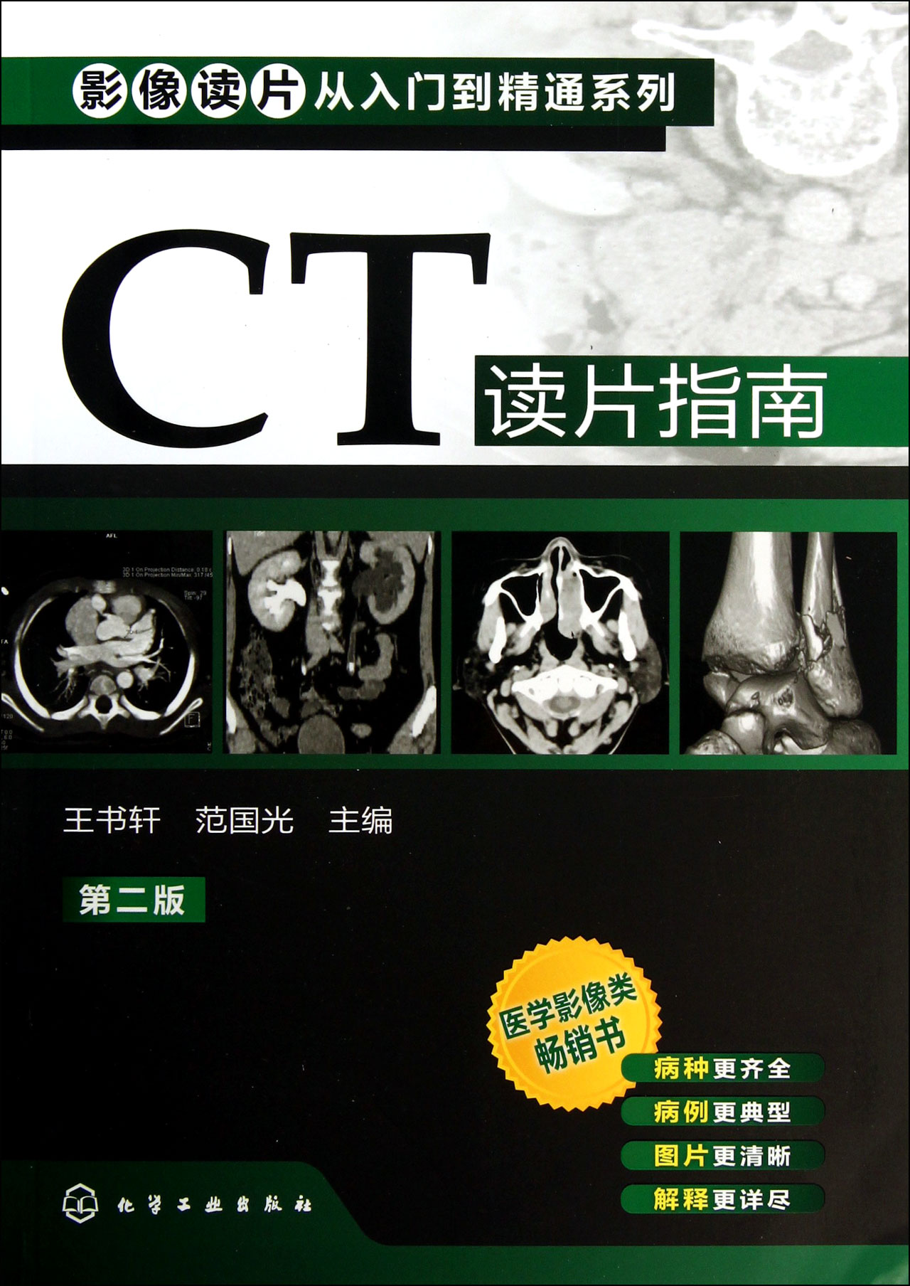 CT读片指南(第2版)/影像读片从入门到精通系列