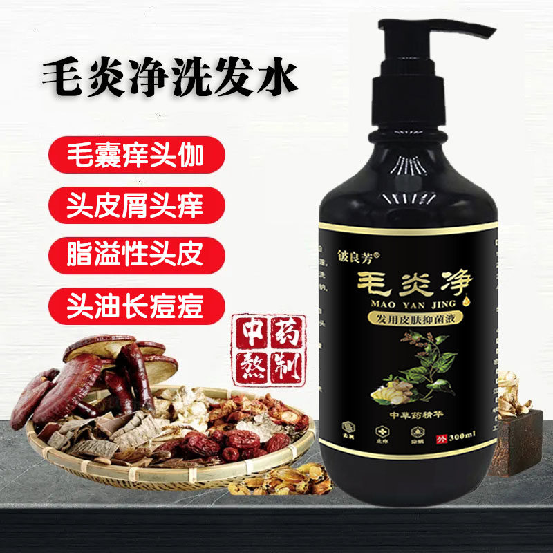 头皮毛炎净洗发水去屑去除螨头上长痘痘毛囊严重头屑头痒