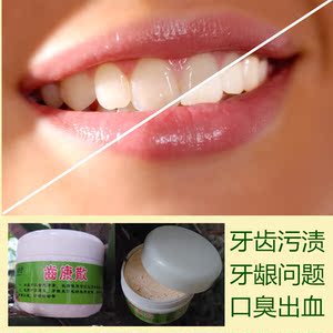 本草牙齿美白洗牙粉液去黄黑牙烟牙烟茶渍牙结石白牙素贴出血口臭
