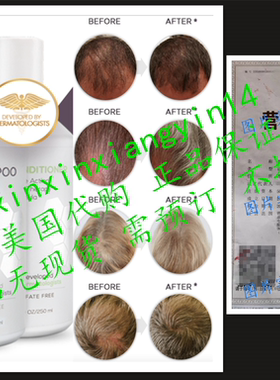 代 Shapiro MD Shampoo and Conditioner for Hair Regrowth