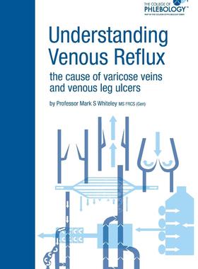 预售 按需印刷 Understanding Venous Reflux the Cause of Varicose Veins and Venous Leg Ulcers