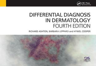 【预售 按需印刷】 按需印刷Differential Diagnosis in Dermatology
