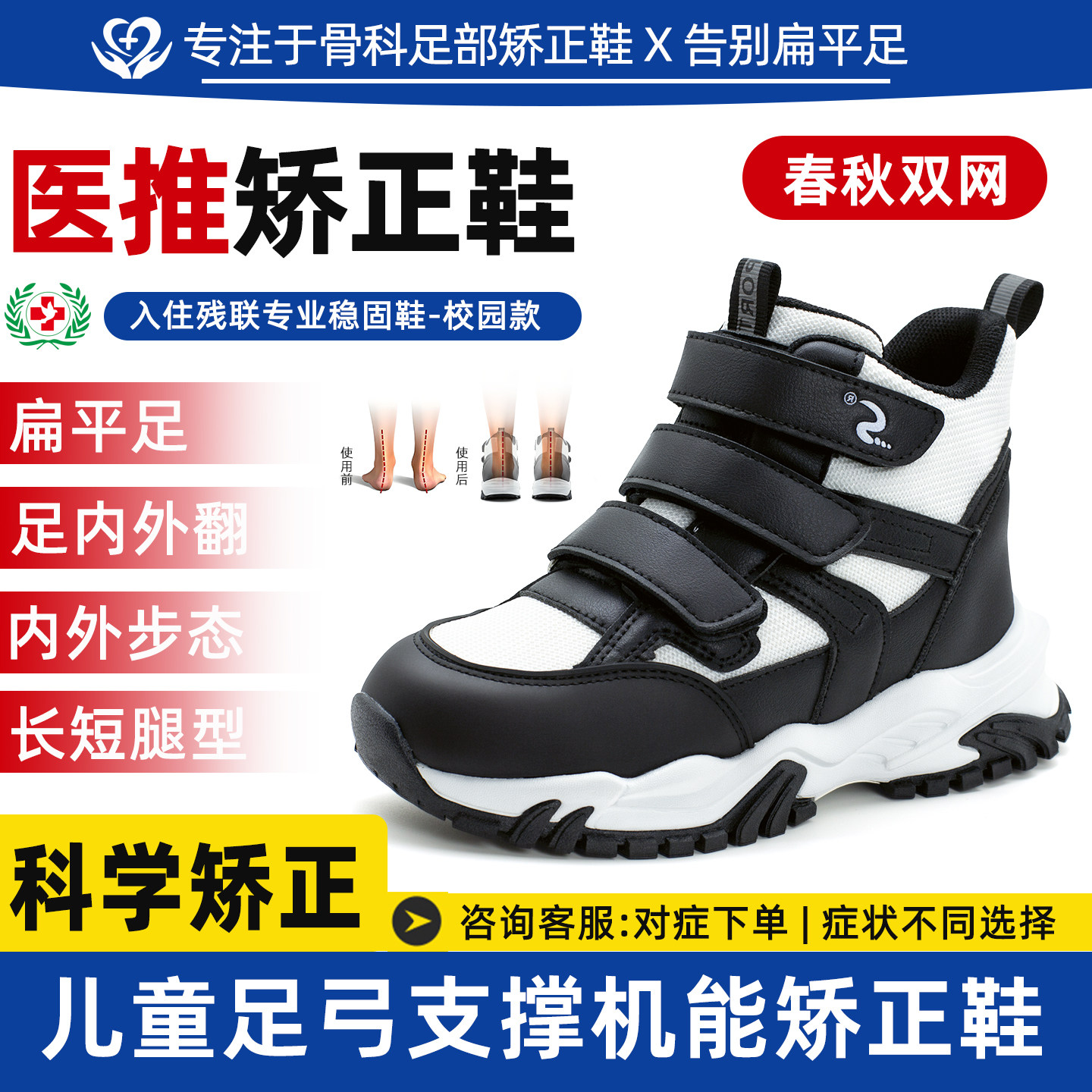 洛崽崽儿童可取模定制矫正内八字