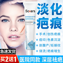 消疤散结修疤凝胶淡化疤淡痕痘印膏疤膏纹绣手术妊娠巴纹修护膏