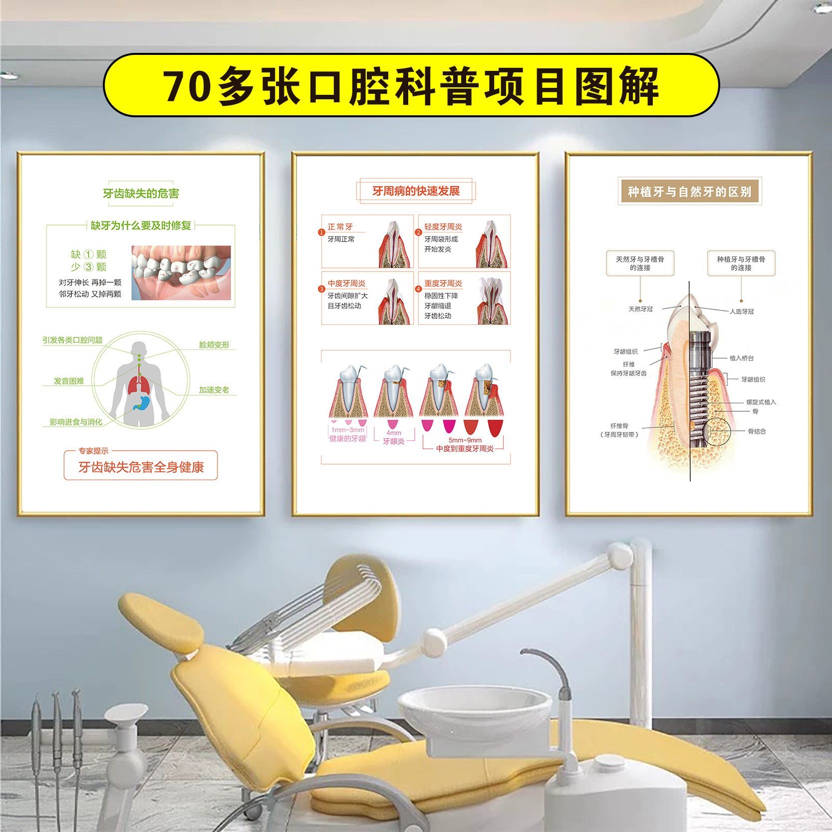 口腔诊所挂画牙科诊室海报宣传挂图口腔科墙面装饰画高档KT板壁画