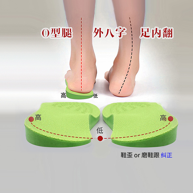 足内翻矫正器o型腿外八字脚鞋垫