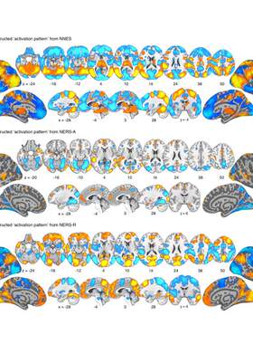 专业3DSlicer影像组学勾画roi分割多模态fMRI/DTI脑影像分析建模