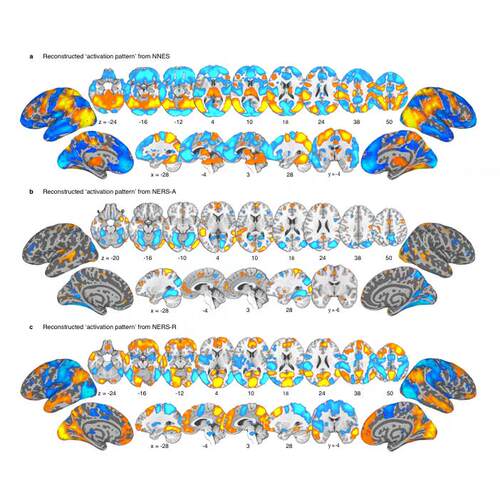 专业3DSlicer影像组学勾画roi分割多模态fMRI/DTI脑影像分析建模
