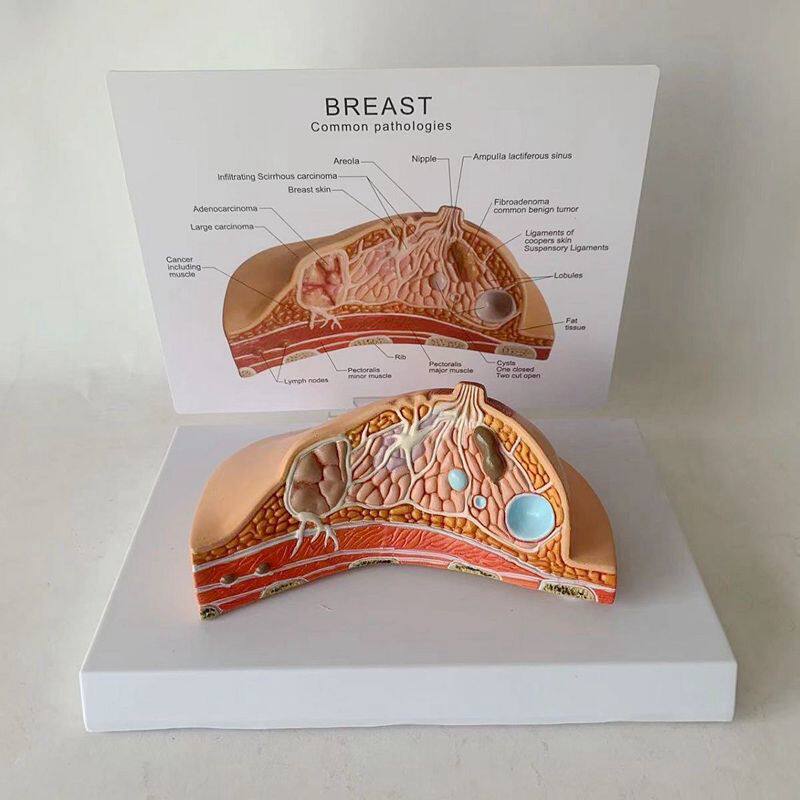 康泰医学乳腺模型病理乳房解剖女性生殖医药促销跨境直播热卖爆品