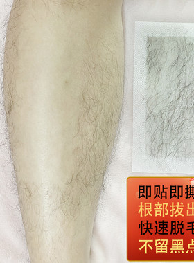 易朵脱毛蜜蜡纸去腿毛四肢脸唇部手臂腋下脱毛膏神器男女士去毛贴
