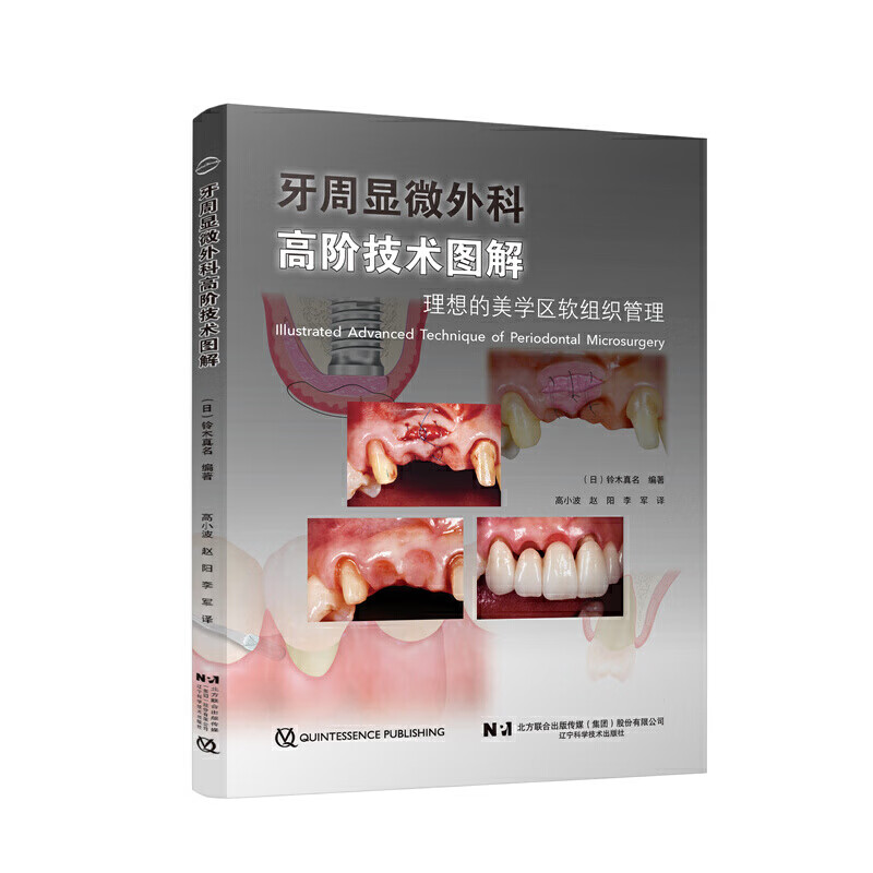 牙周显微外科高阶技术图解 理想的美学区软组织管理 高小波 赵阳 李军 译
