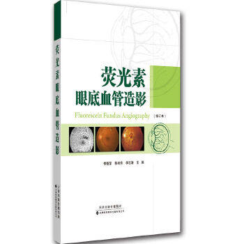 荧光素眼底血管造影 荧光造影 虹膜血管造影 血管造影对眼底病的诊断 视网膜血管性疾病 视神经疾病 葡萄膜炎眼内肿瘤