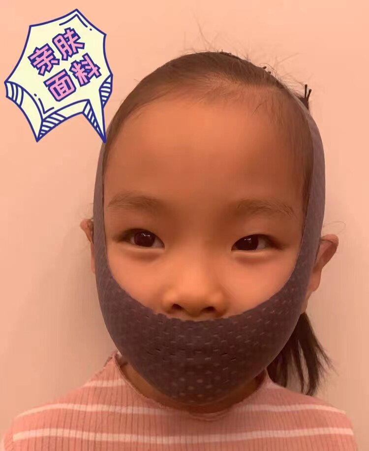 儿童口呼吸矫正带瘦脸神器祛法令纹双下巴提拉紧致绷带睡眠