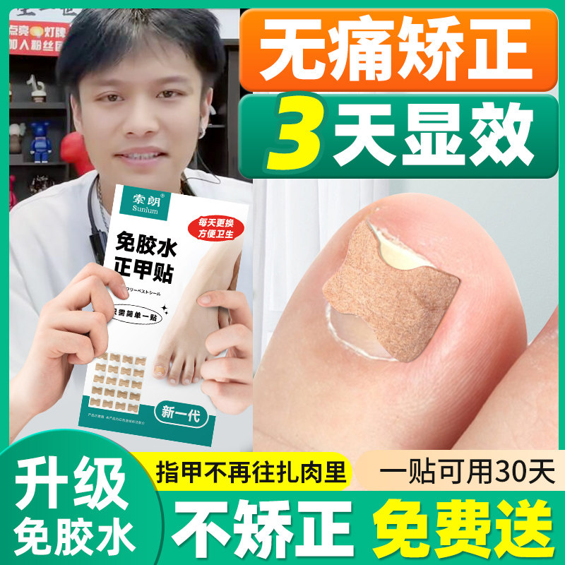 速发正甲贴甲沟嵌甲矫正脚指甲纠正器甲沟矫正贴脚趾甲沟正甲片炎