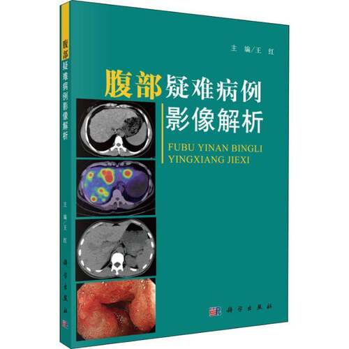 RT现货速发 腹部疑难病例影像解析9787030582959 王红科学出版社医药卫生书籍
