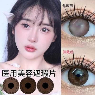 医用美容片眼球瑕疵遮瑕有无视力年抛隐形眼镜美瞳虹膜盲片1片LE