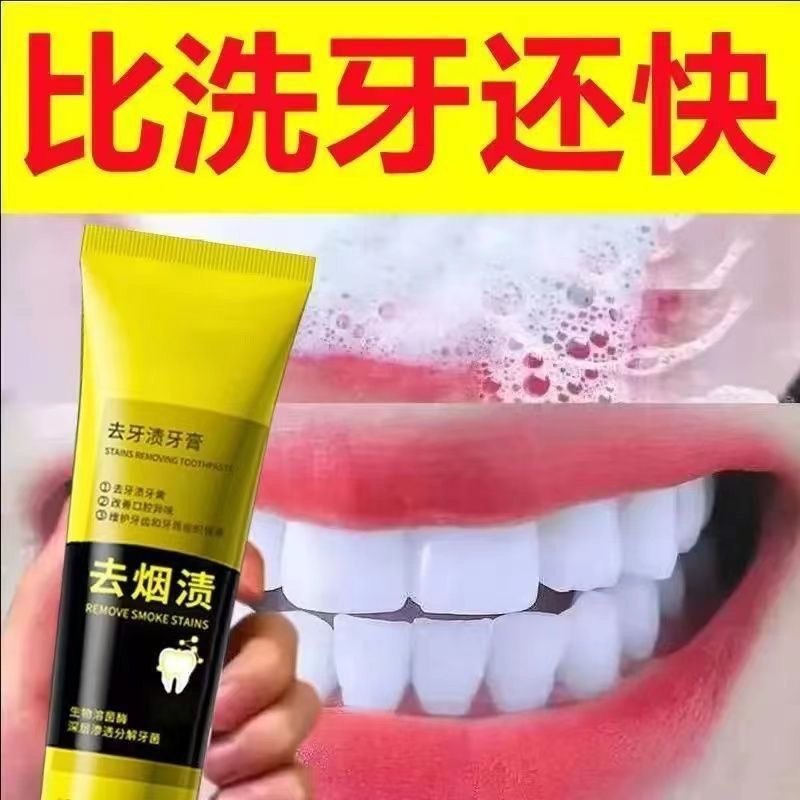 正品去烟渍牙膏菌斑去牙渍清新口气烟民牙齿黄牙亮白美白口腔去臭