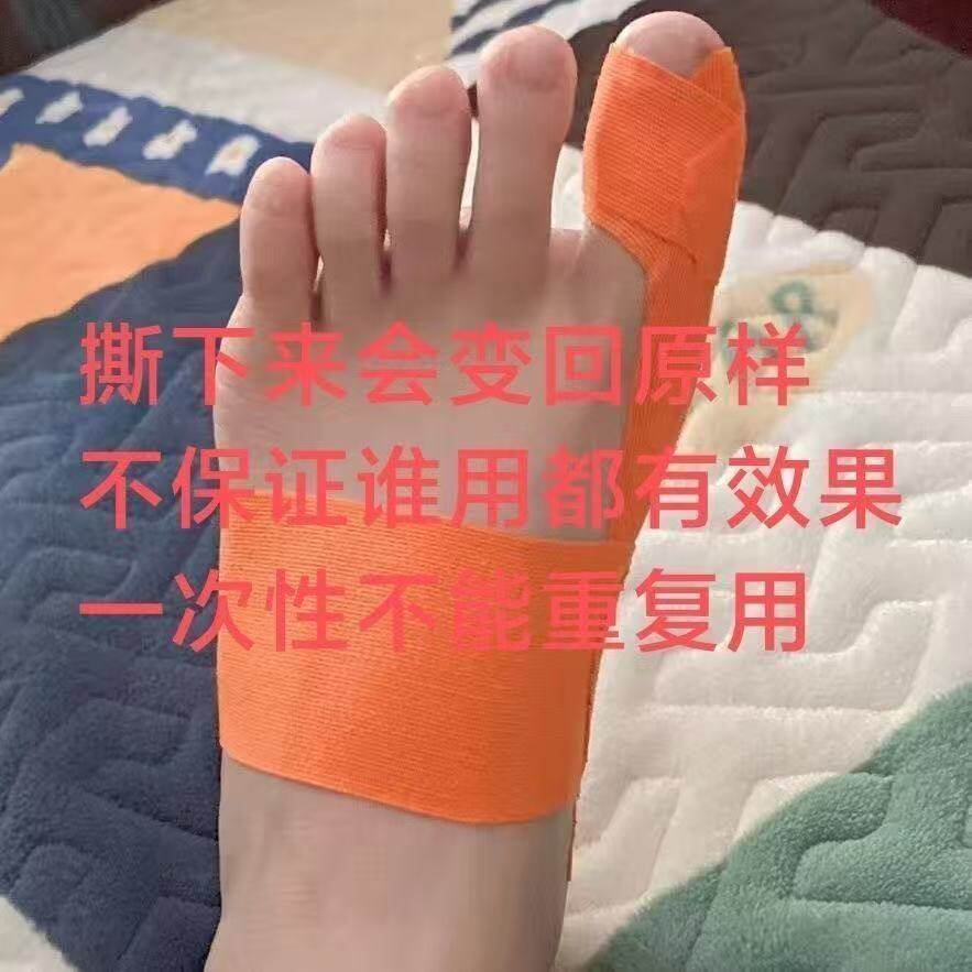 纠正脚趾神器拇指外翻分趾器大母足脚趾肌肉贴肌内效弹性运动绷带