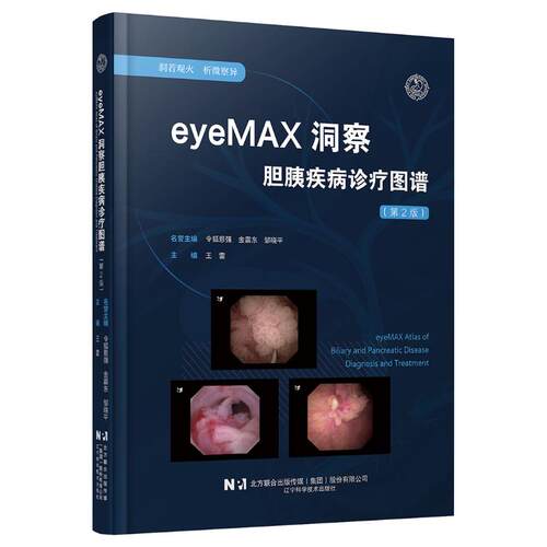 asywx EYEMAX洞察胆胰疾病诊疗图谱（第二版） 王雷 著 9787559141163 辽宁科学技术出版社