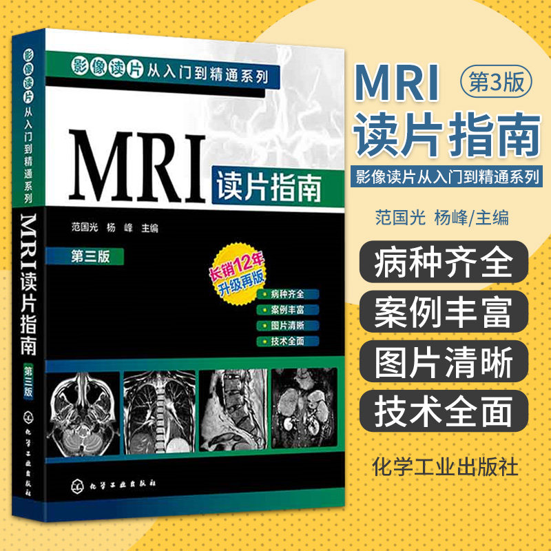 hg MRI读片指南 第三版 影像读片从入门到精通系列 范国光 杨峰 主编 化学工业出版社 颅内肿瘤 成人弥漫性胶质瘤 室管膜瘤
