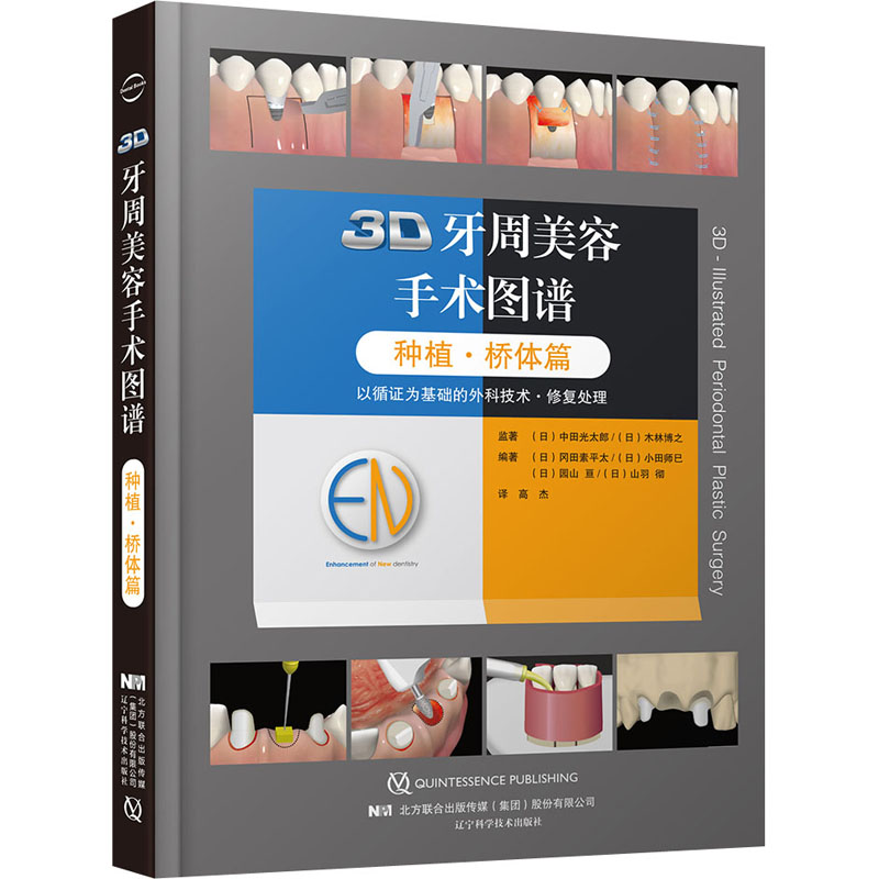 asywx 3D牙周美容手术图谱 种植·桥体篇 [日]山羽 著,高杰 译 9787559117243 辽宁科学技术出版社