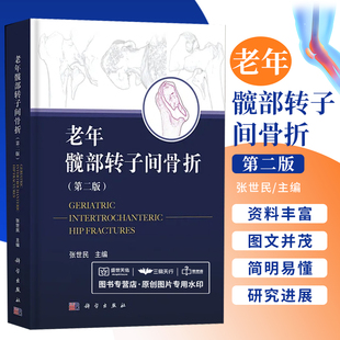 老年髋部转子间骨折 第二版 第2版 张世民 人工髋关节置换手术实用外科学手术学骨折关节重建技术书籍临床外科翻修术 科学出版社